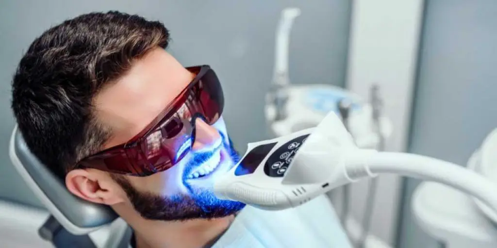 How Much Does it Cost to Get Your Teeth Whitened in The UK? - Ask-Albert