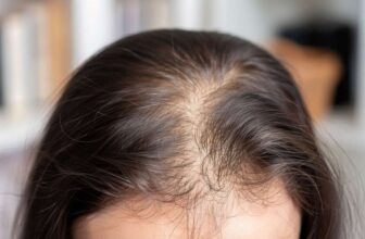 Soluciones Capilares Innovadoras y Efectivas